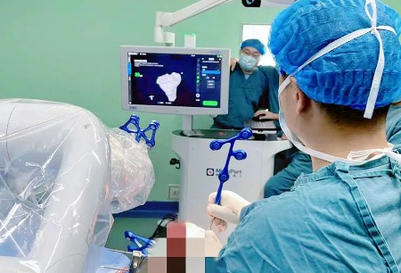 Yunnan Tour of Honghu | The First People's Hospital of Zhaotong, the largest 3A Hospital in Zhaotong City, Successfully Completed The Robot-Assisted TKA